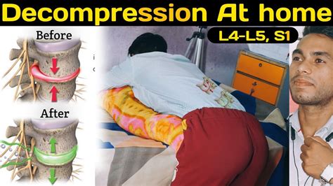 s1 compression test|l5 s1 nerve impingement exercises.